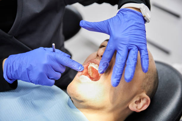 Best Emergency Gum Treatment in Oakwood, OH