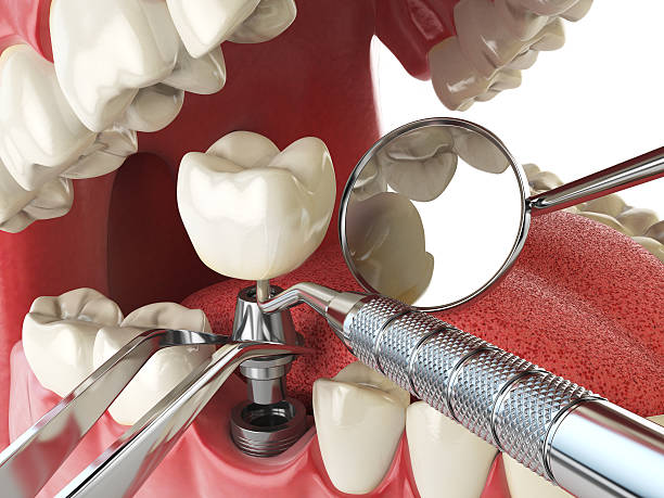 Best Cosmetic Emergency Dentistry in Oakwood, OH